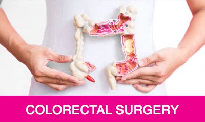 colorectal cancer treatment in visakhapatnam