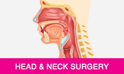 head neck surgery treatment in vizag