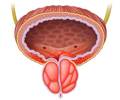 Prostate Cancer hospital in vizag