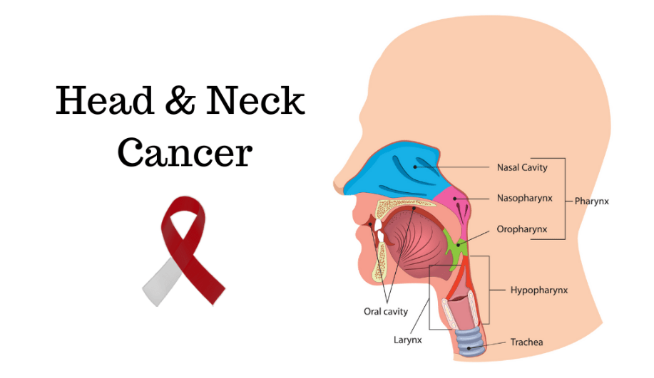 head & neck cancer