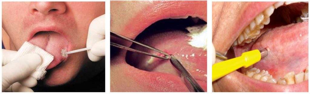 VELscope Enhanced Oral Assessment System availability at Mahatma Gandhi ...